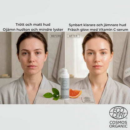SKINØ Nordic Glow Serum vitamin C serum resultat – before and after med synbart klarare, jämnare och mer strålande hud, fräsch glow och jämnare hudton med vitamin C och hyaluronsyra.