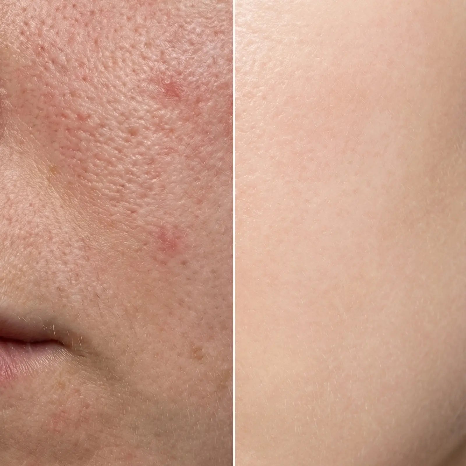 SKINØ Peptide Anti-Aging Serum före/efter resultat – glattere hud, minskade fina linjer efter 4 veckor.